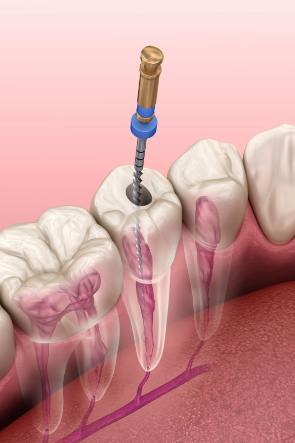 Endodontie